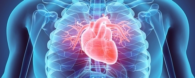 Anévrisme aortique traité en Radiologie Interventionnelle CHU Dijon