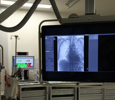 L’ablation tumorale percutanée. Techniques thérapeutiques par l'imagerie CHU Dijon