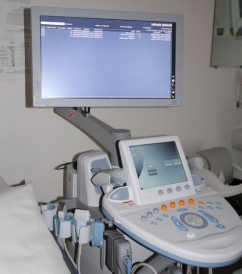 Traitement des varices pelviennes technique mini-invasive Radiologie Interventionnelle CHU Dijon